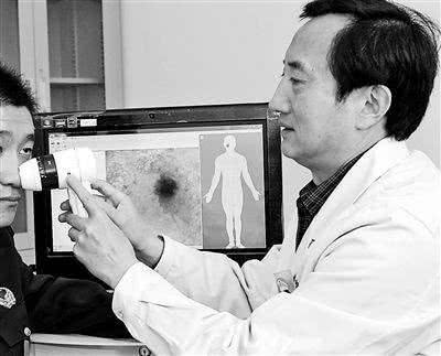 伍德氏灯检查白癜风准确率,怀疑自己白癜风做什么检查