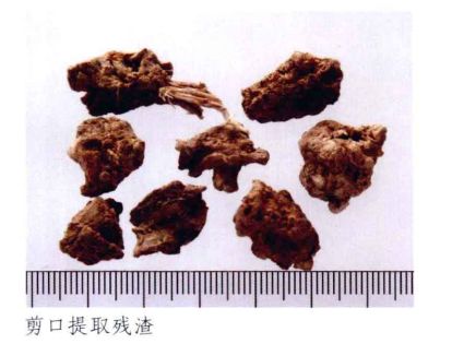 云南三七真伪查询,三七药材的真伪鉴别