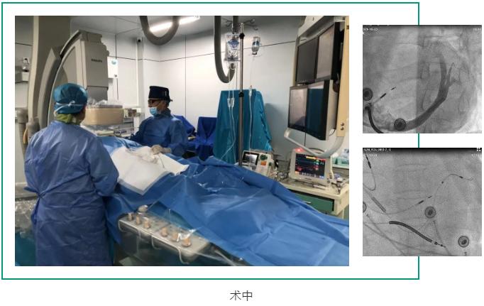 淄博市中心医院心力衰竭,淄博中心医院西院区手术