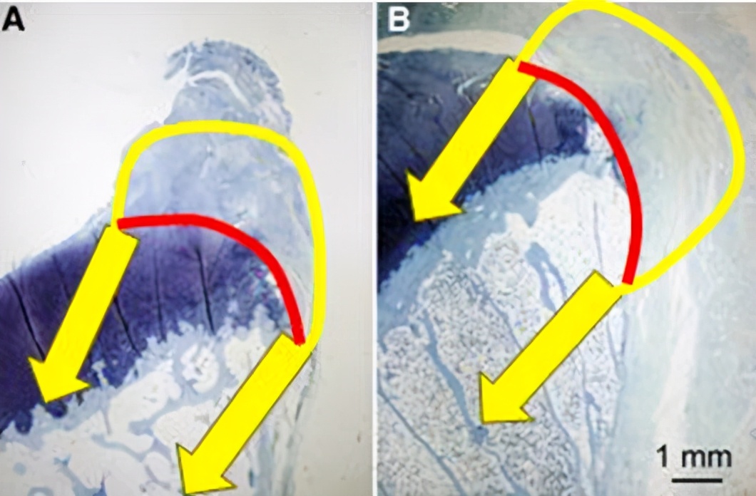 肩关节正斜位怎么治疗,怎么判断肩关节稳定不稳定