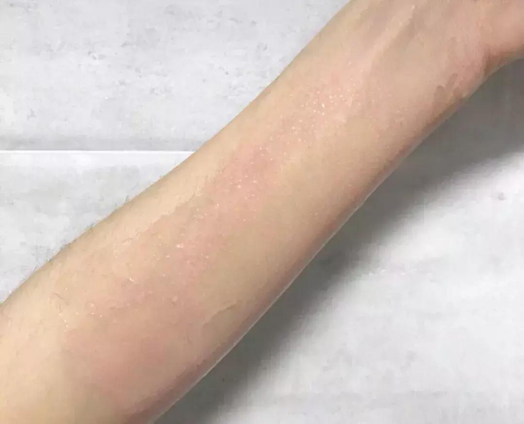 年度爱用护肤好物推荐,年度爱用护肤品混合肤质挚爱回购