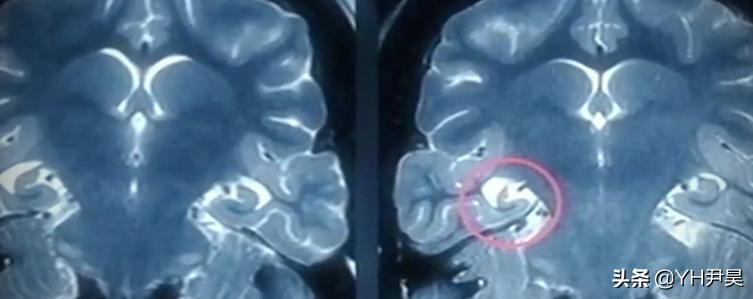 1998年美国海岸大批生物突发异样，专家共同侦查，真凶竟是天气