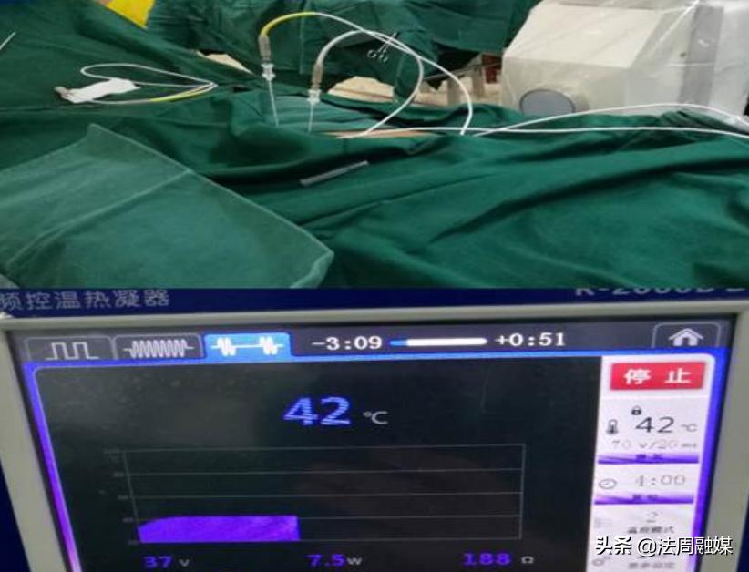 常德名医篇┃常德市第二人民医院疼痛科主任宋海侧记