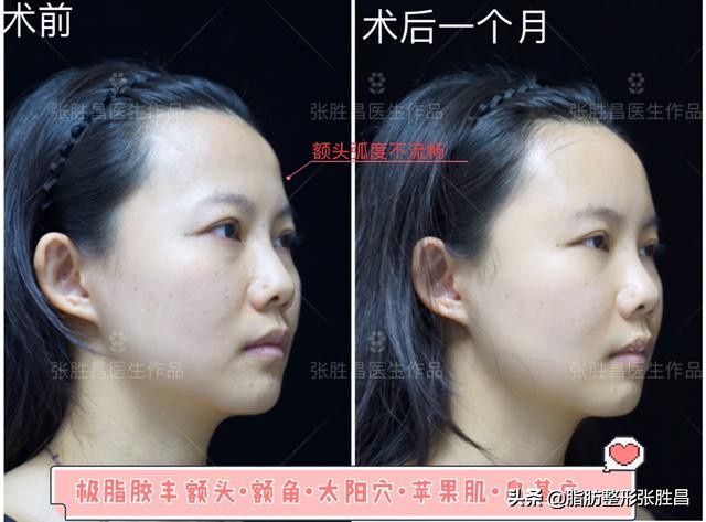 快速有效暴瘦腰腹练出马甲线,紧致身材零赘肉这样健身才最有效