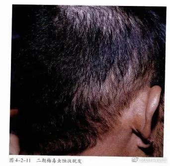 自我剖析问题原因和整改措施,自我诊断原因分析及改进措施