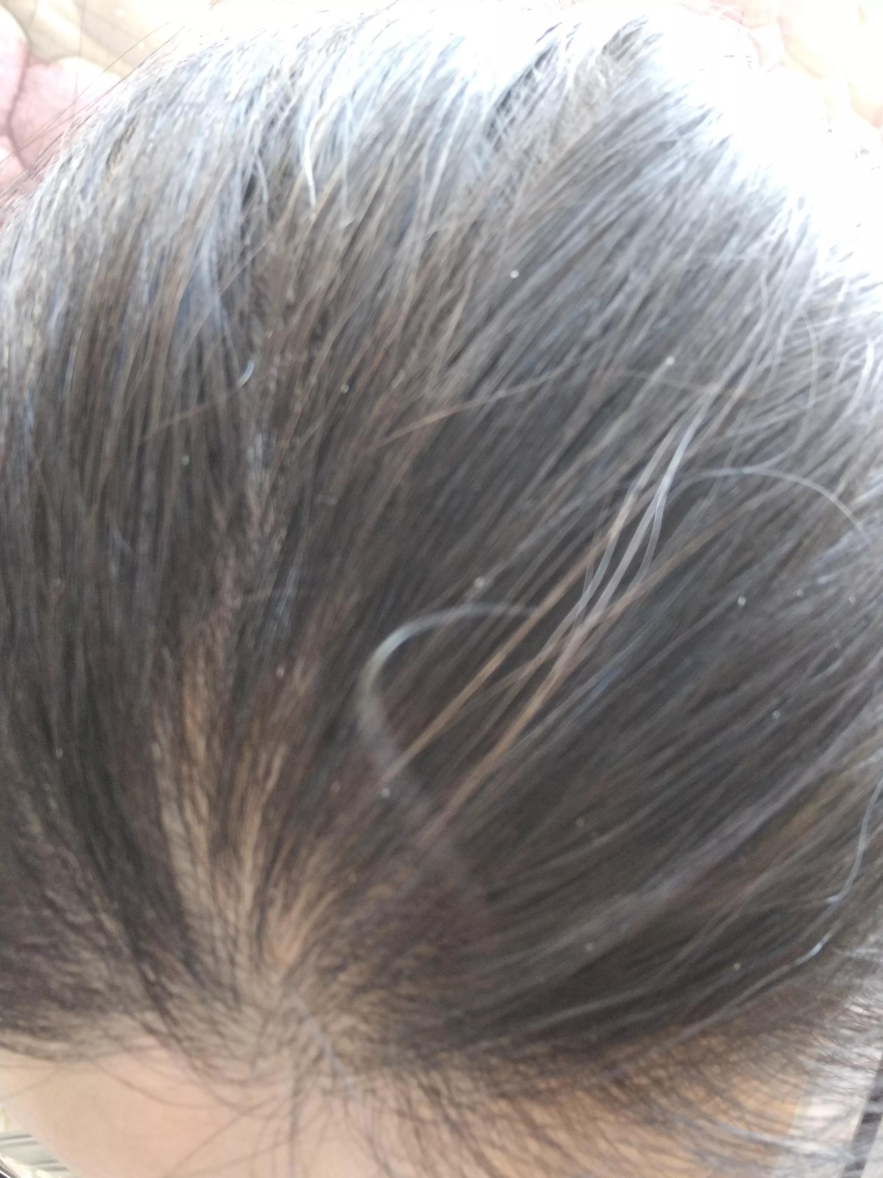 啤酒驱虫小妙招,啤酒洗头去白发