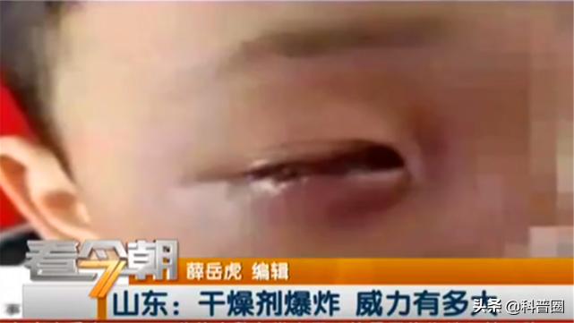 干燥剂爆炸小孩眼睛咋处理,干燥剂遇水爆炸导致小孩眼球溶解