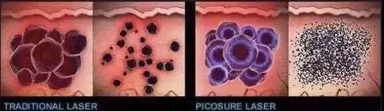 皮秒了解,皮秒使用方法教程