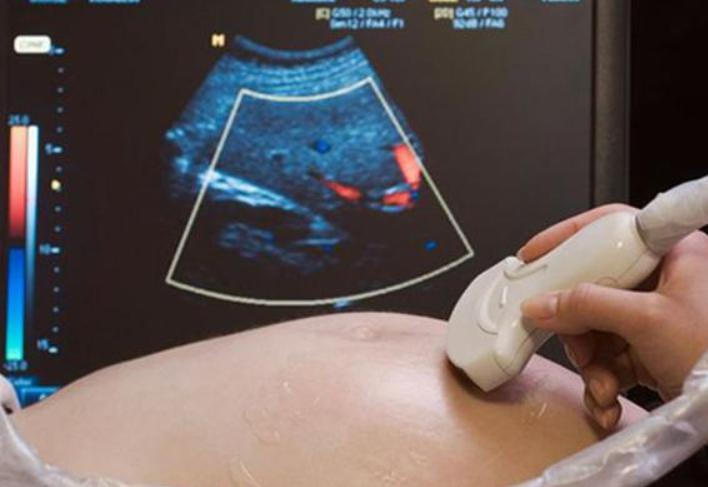 孕妇哪个阶段胖得最快,孕妈怎么才不会变胖