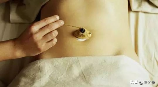 艾灸发痒?真相惊人