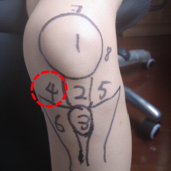 不同膝盖疼痛是暗示什么,不同位置的膝盖疼