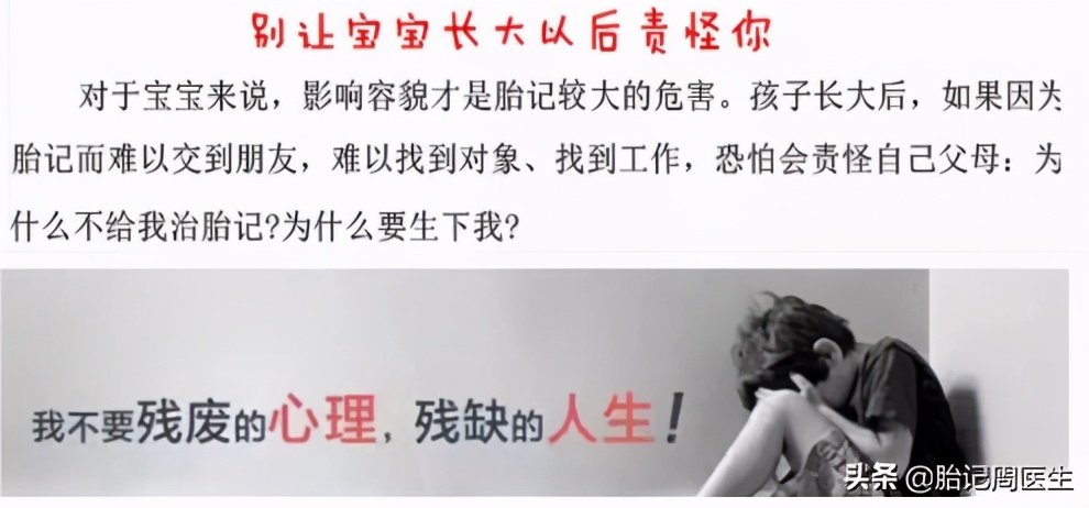 经常喝咖啡真的会导致脸上长斑吗,小孩脸上有斑怎么办