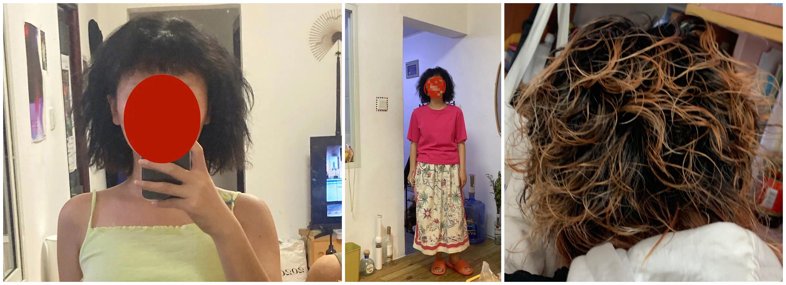 被发质问题困扰,被头发困扰20多年