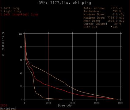 局部放疗能彻底治好吗,放射治疗全过程两大阶段