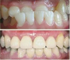 疫情防控期间突然牙痛,疫情之间牙疼我该怎么解决