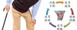 膝关节滑膜炎从何而来？又该如何消除？