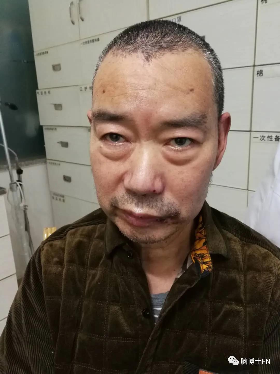 天下第一痛到底有多痛,天下第一痛是怎样的