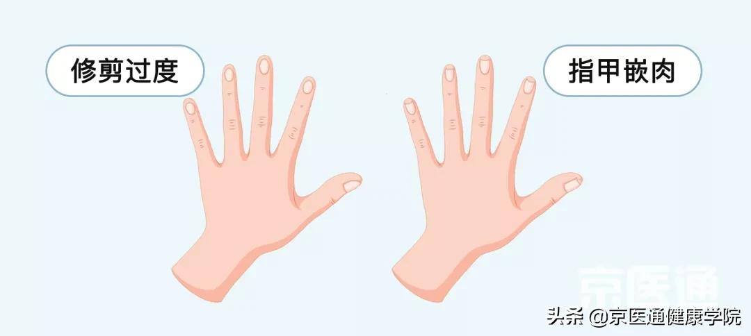 刷牙、剪指甲、滴眼药...这些生活技能很多人都做错了