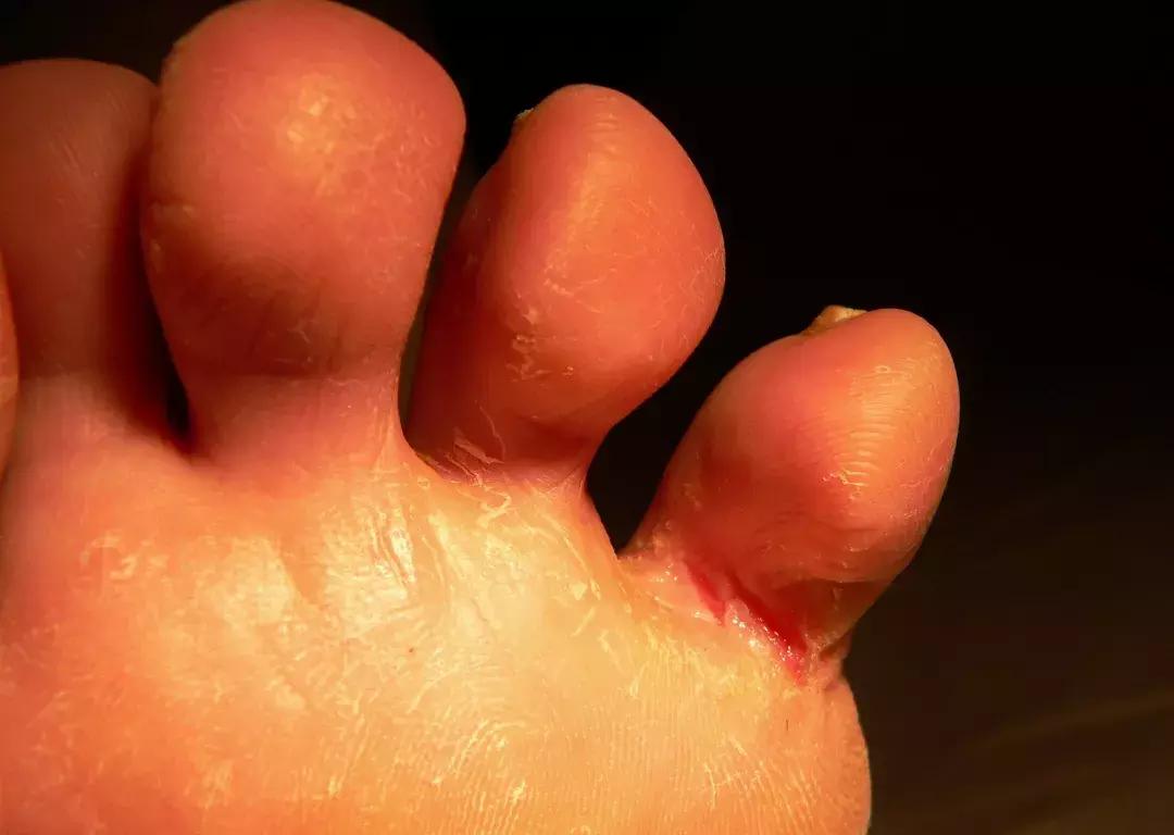 袜子和裤子能放一起吗,袜子和裤头能一起洗吗