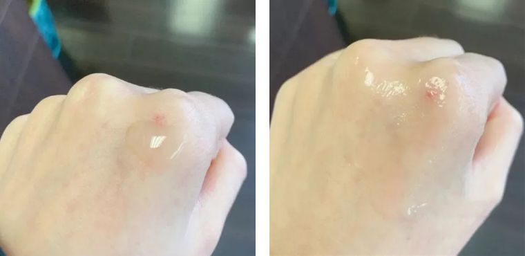 精华最好用的品牌,什么牌的精华液好用又平价