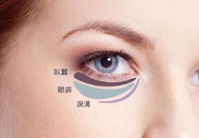 眼袋越来越严重怎样才能改善眼袋,眼袋有皱褶最简单的去眼袋的方法