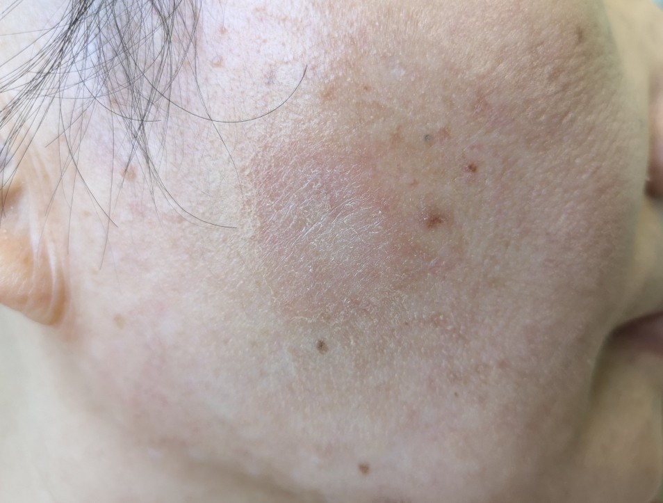 搓泥的真的是污垢吗,搓泥现象是护肤品的问题吗