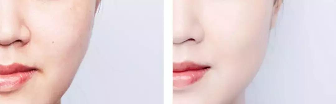 10款爆款平价气垫,公认干皮最好的气垫秋冬