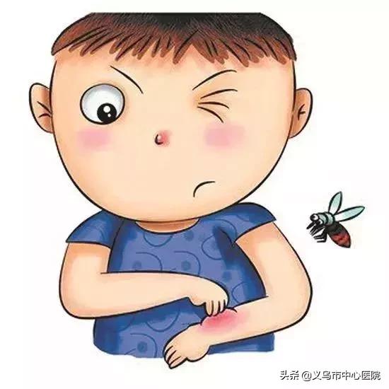 皮肤吸引蚊子怎么办,皮肤防蚊子方法