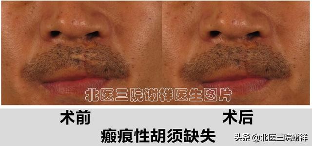 男性如何增加自己的魅力,男性提升魅力的捷径