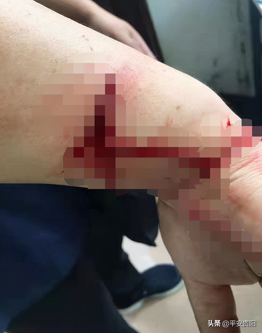 越来越嚣张了怎么办,越来越嚣张怎么解决