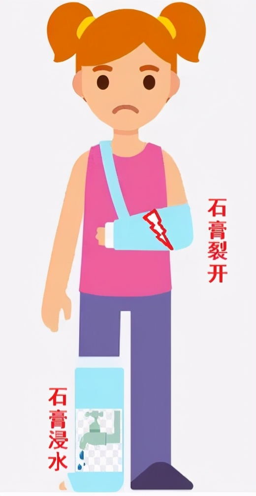 儿童打完石膏要多久复查,幼儿膝盖骨折打石膏注意事项