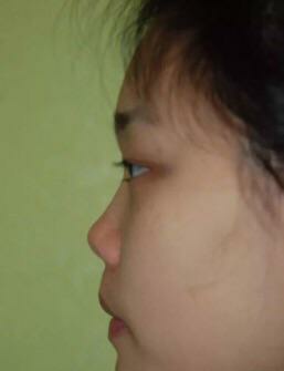 有哪些明星是朝天鼻,塌鼻好看的明星