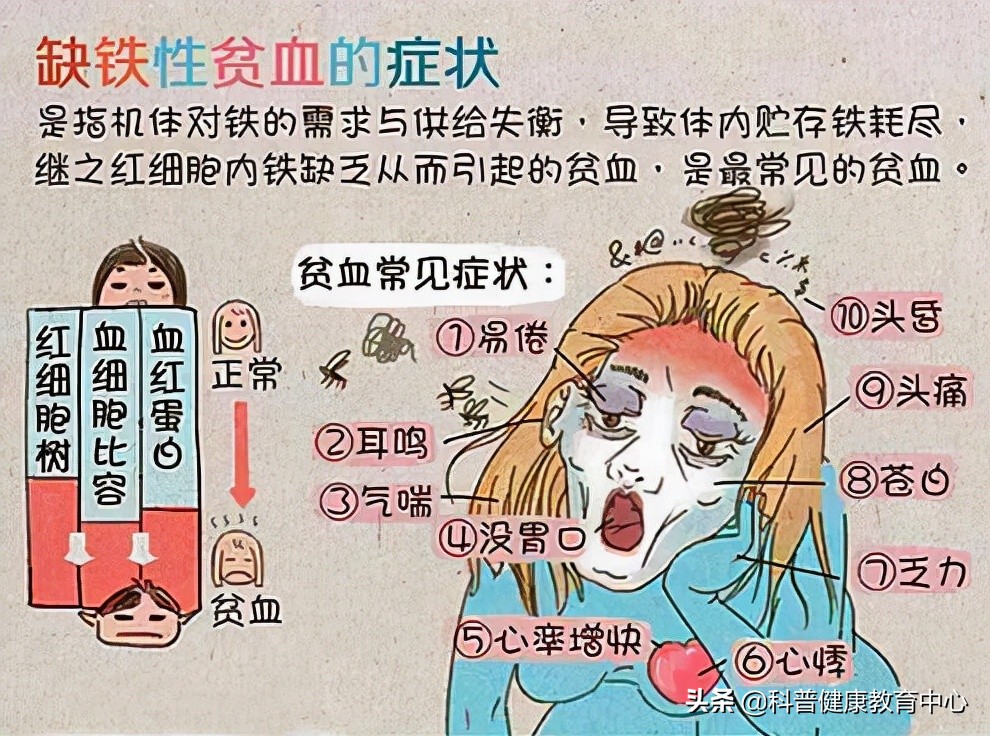 缺铁性贫血临床现状和最新进展,中国缺铁性贫血新闻