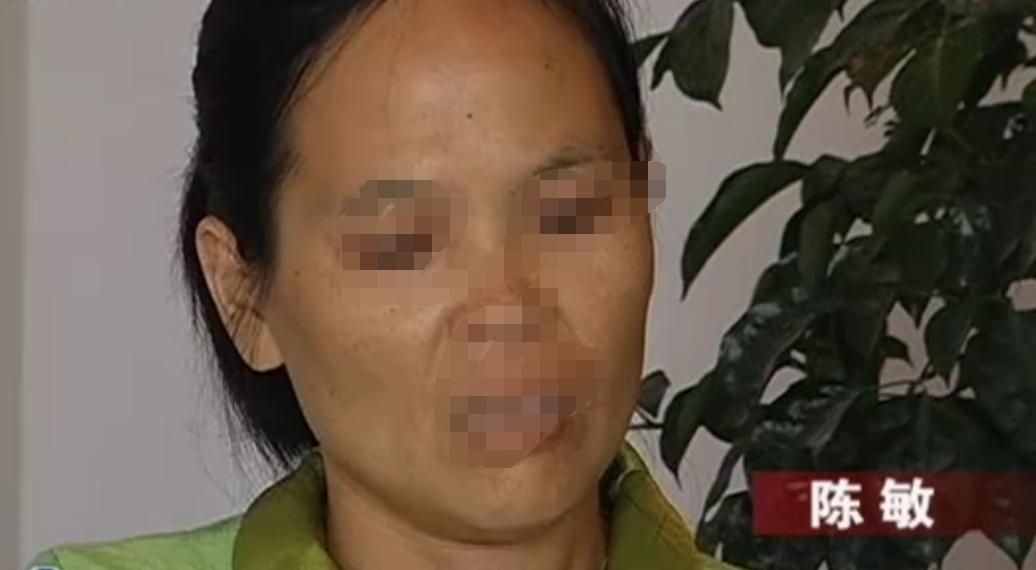 被告知左侧卵巢已被切除,年轻女子卵巢切除