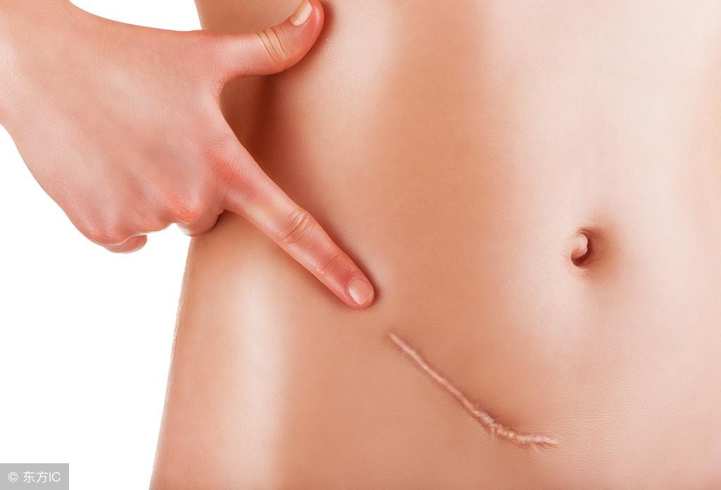 哪些是宫颈炎的早期症状