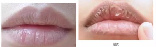 周冬雨唇形,周冬雨的脸高级吗