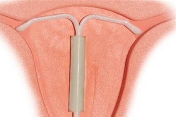 上了节育环16年取出来有什么危险,48岁女取环容易怀孕吗