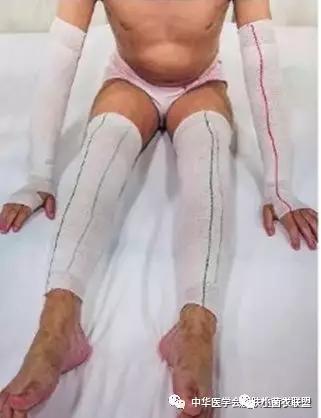 治疗皮肤瘙痒的有效药物是啥,皮肤瘙痒用什么药膏无激素