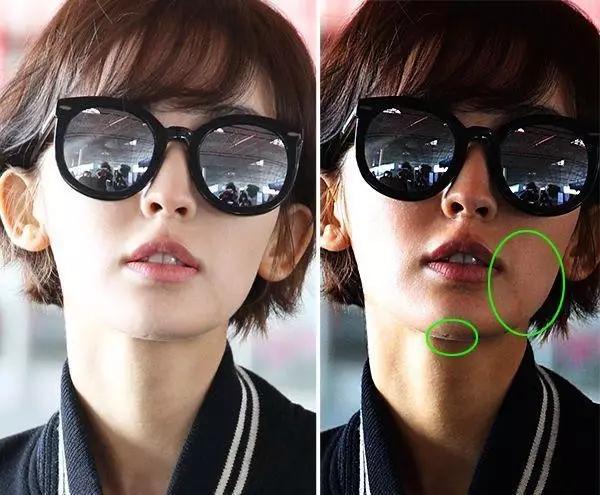 原来娜扎刘诗诗脸上的闭口这么严重！网传去闭口方法有没有用？