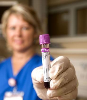 癌症的发生与哪些因素有关,癌症的发生需要多久