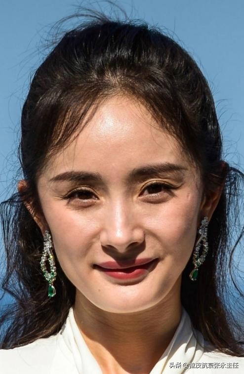 眼睑下垂什么原因造成的,眼皮松弛下垂是什么原因造成的