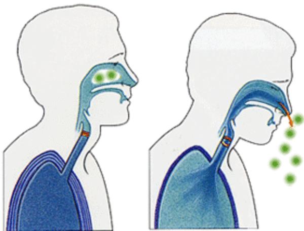 经常打喷嚏是什么病用什么药治,经常打喷嚏的10种征兆