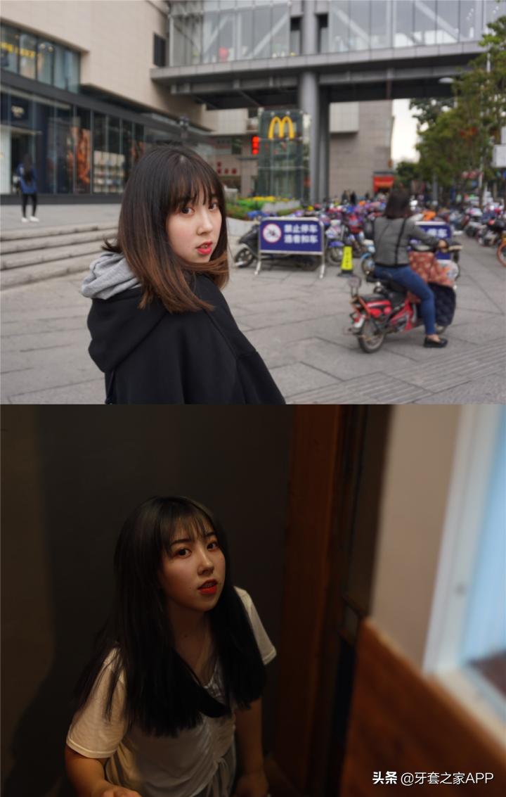 不靠整容怎么改变下巴后缩?看这里