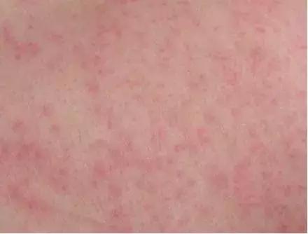 行军拉练，是时候保护好自己的“面子”了