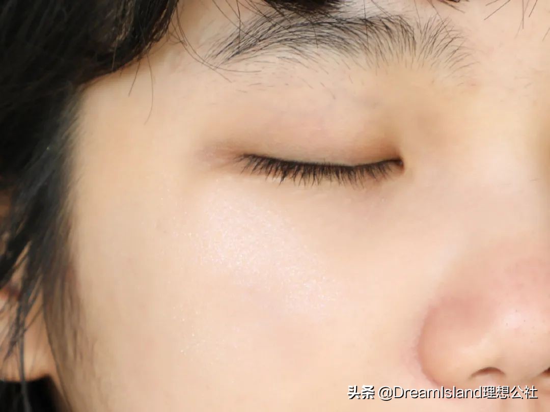 玻尿酸高光排名,打玻尿酸高光推荐