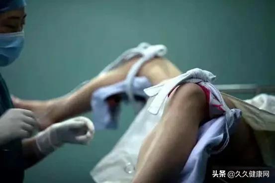 药流人流引产区别,人流与药流引产的区别