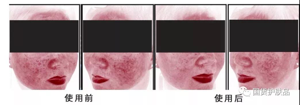 十大公认好用的水乳套装国货,有哪些好用的水乳套装国货