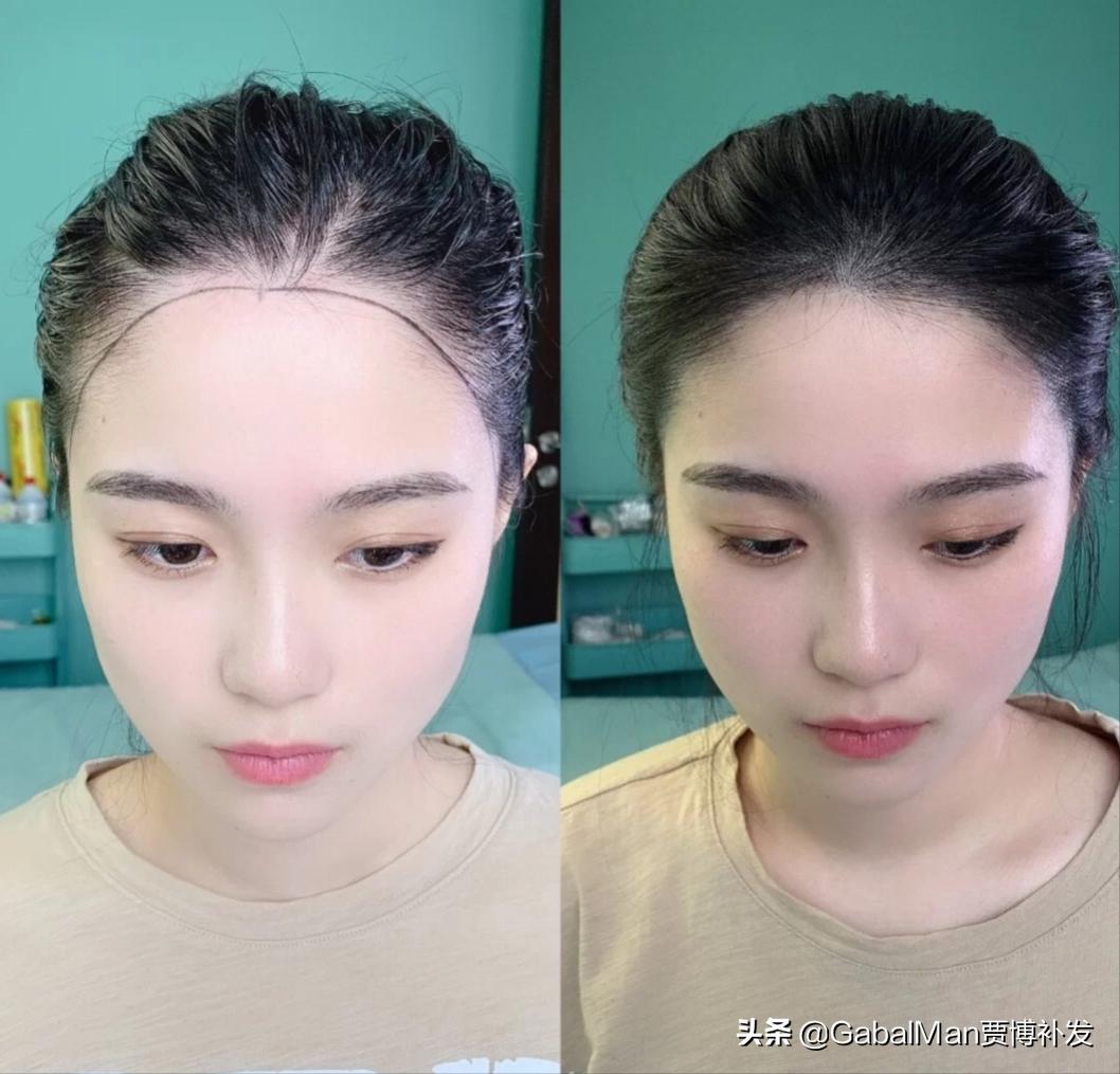 发际线极为危险,发际线有什么讲究