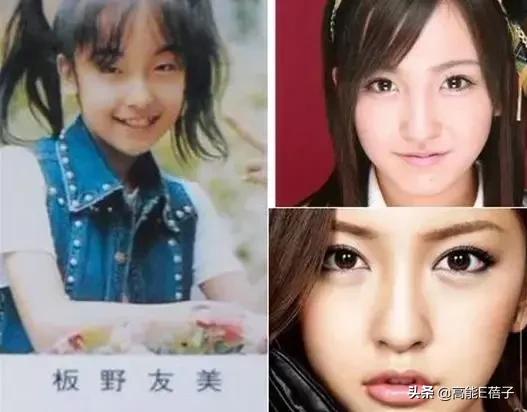 微整形需要多久,最受欢迎的5大微整形