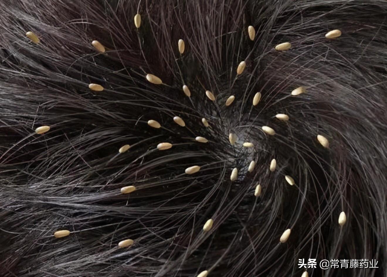 头虱可以用驱虫药吗,有头虱和虫卵用什么药物